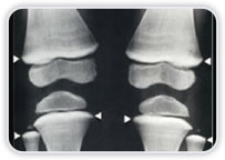 Radiografia (Raio-x)