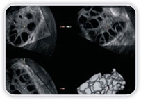 Ultrassonografia - Ginecológico
