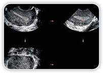 Ultrassonografia - Ginecológico